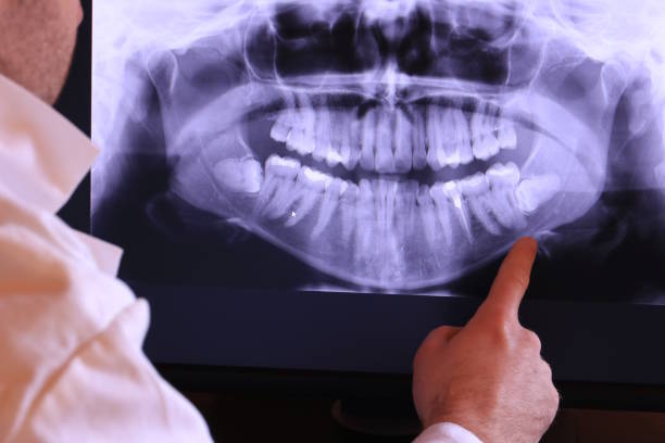 Best Pediatric Emergency Dentist in Barton, NM