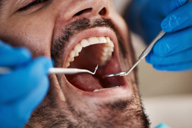 Best Urgent Care for Lost Fillings or Crowns in Barton, NM